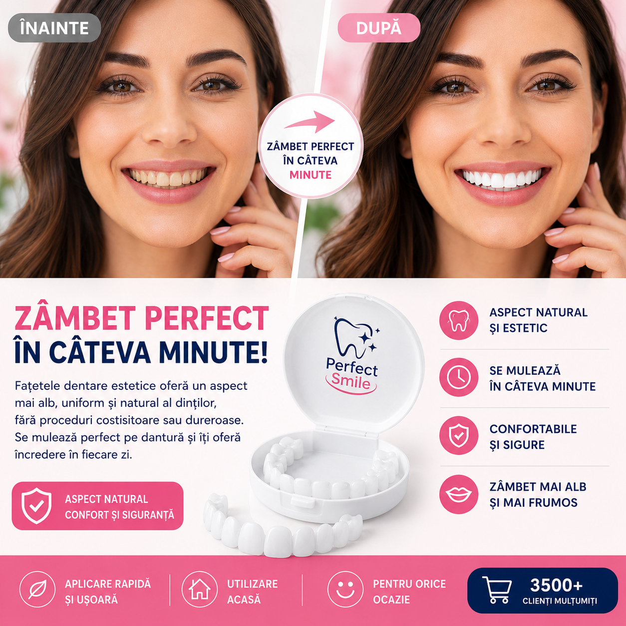 Fatete dentare PerfectSmile