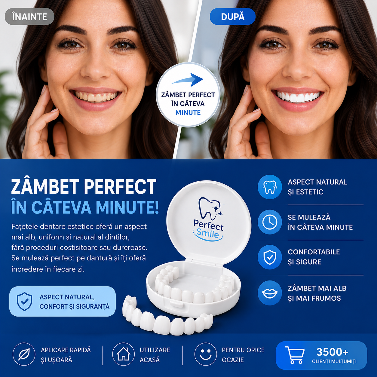 Fatete dentare PerfectSmile